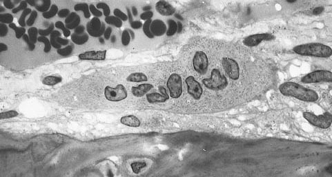 osteoclast