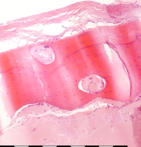 Immature bone