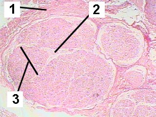 Fig 032-001