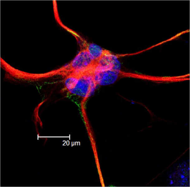 Astrocyte