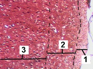 Fig 61-004