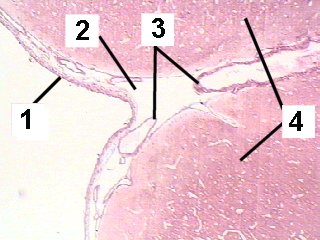 Fig 61-005