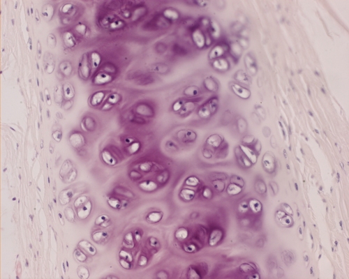Hyaline cartilage