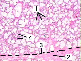 Fig 11