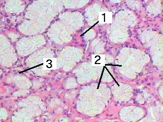 Fig 12